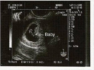 babys1st.jpg