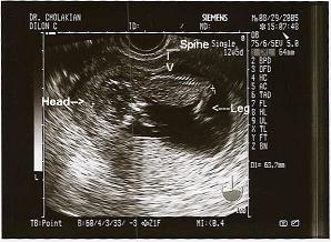 12w5d.jpg