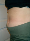 8weekbelly.jpg