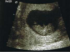 9wkbabydavis.jpg
