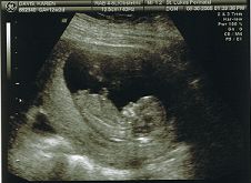 babydavis12w2.jpg