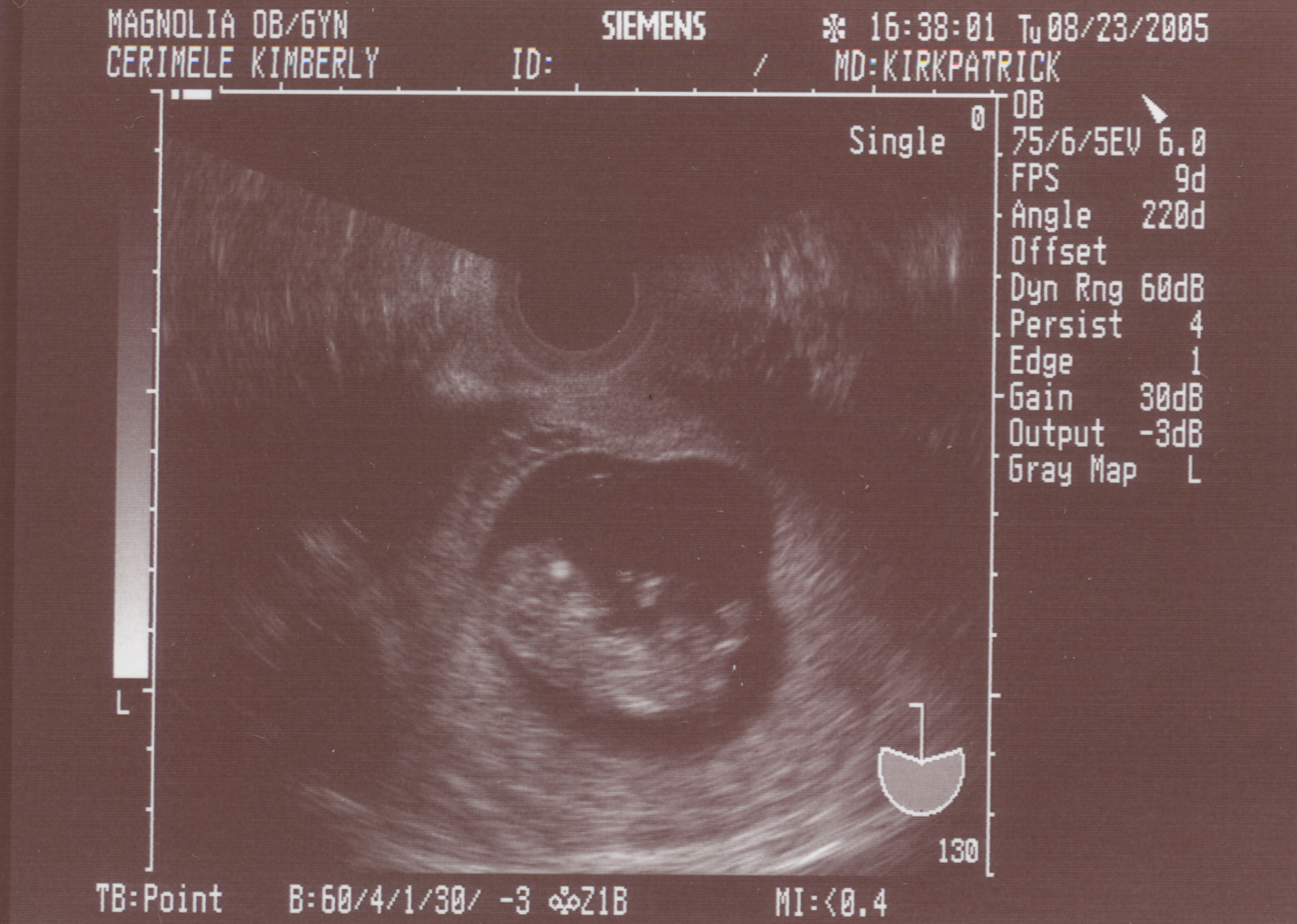 ultrasound10w3d.jpg