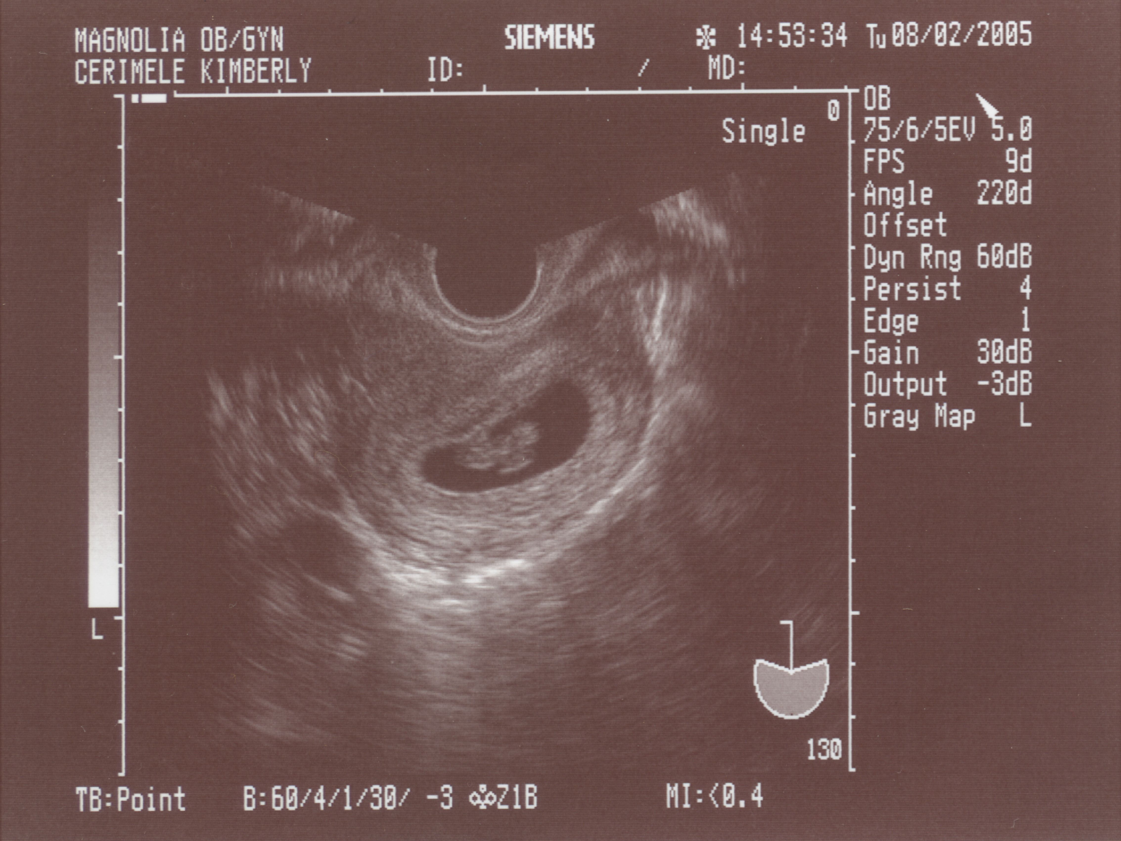 ultrasound2.jpg